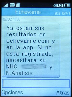 Centro Médico Cea Bermúdez, Madrid, Spanien, Zugang Ergebnisse Online per SMS auf einem Alcatel 2051X Mobiltelefon