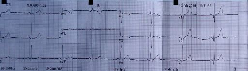 Centro Médico Cea Bermúdez, Madrid, Spanien, Ergebnis EKG ohne Belastung