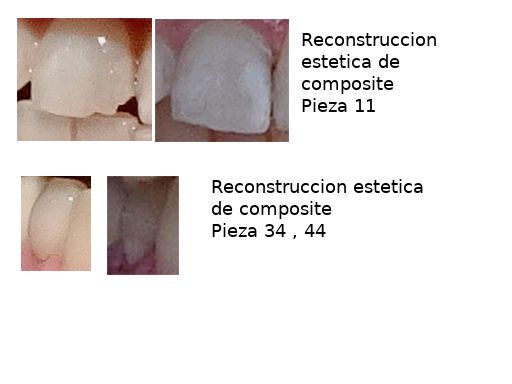 Clínica Odontológica de Postgrados Universitarios, Zahnarztpraxis, Madrid, Spanien, Füllungen für je 40,– €