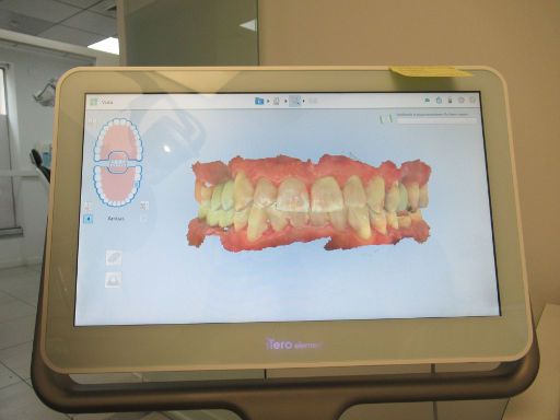 Clínica Odontológica de Postgrados Universitarios, Zahnarztpraxis, Madrid, Spanien, iTero Element 5D Intraoralscanner