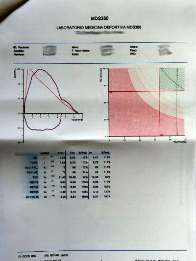 mds360 medicina deporte salud, Madrid, Spanien, Ergebnis Lungenvolumen