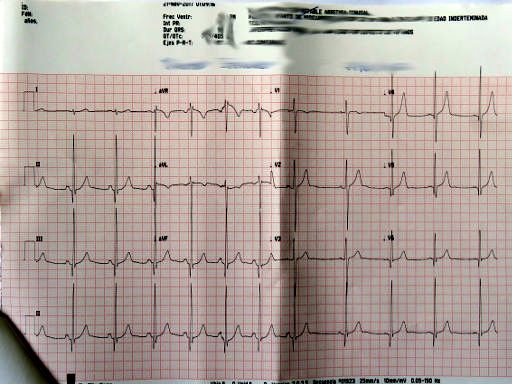 mds360 medicina deporte salud, Madrid, Spanien, Ergebnis EKG ohne Belastung